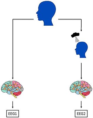 Predicting the Effects of Repetitive Transcranial Magnetic Stimulation on Cognitive Functions in Patients With Alzheimer's Disease by Automated EEG Analysis